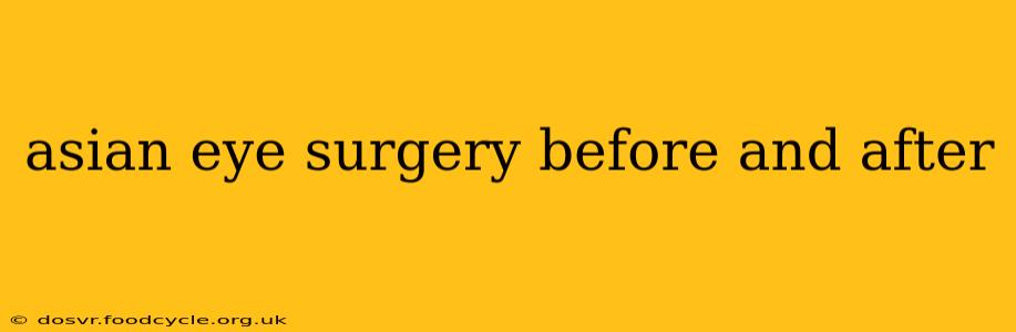 asian eye surgery before and after