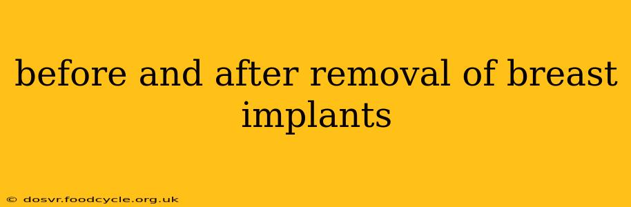 before and after removal of breast implants