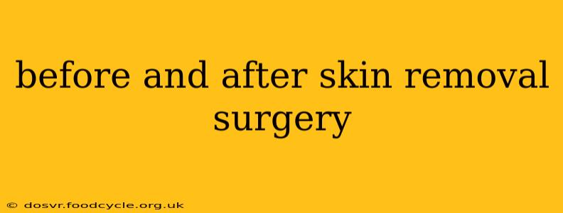 before and after skin removal surgery