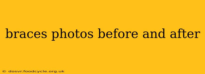 braces photos before and after