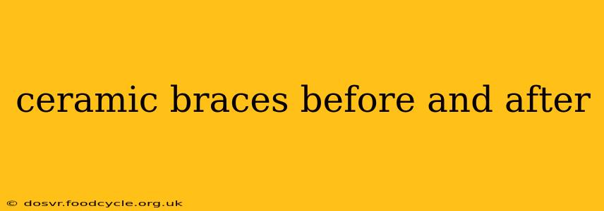 ceramic braces before and after