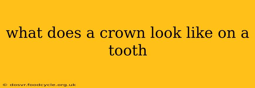 what does a crown look like on a tooth