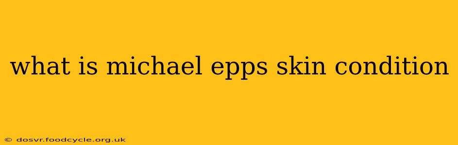 what is michael epps skin condition