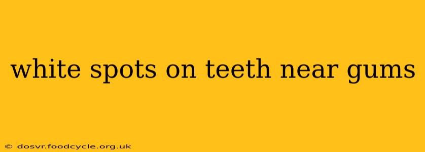 white spots on teeth near gums