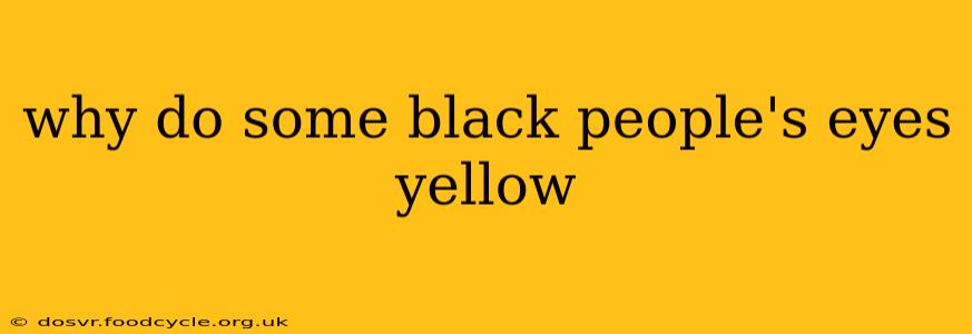 why do some black people's eyes yellow