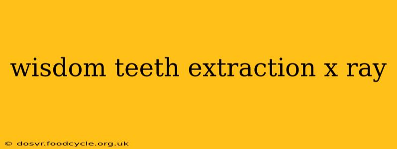 wisdom teeth extraction x ray