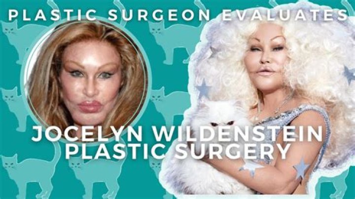 Plastic Surgery Queen Jocelyn Wildenstein Files For Bankruptcy