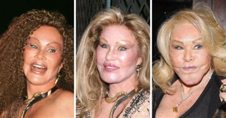 The Strange Life And Many Plastic Surgeries Of Jocelyn Wildenstein