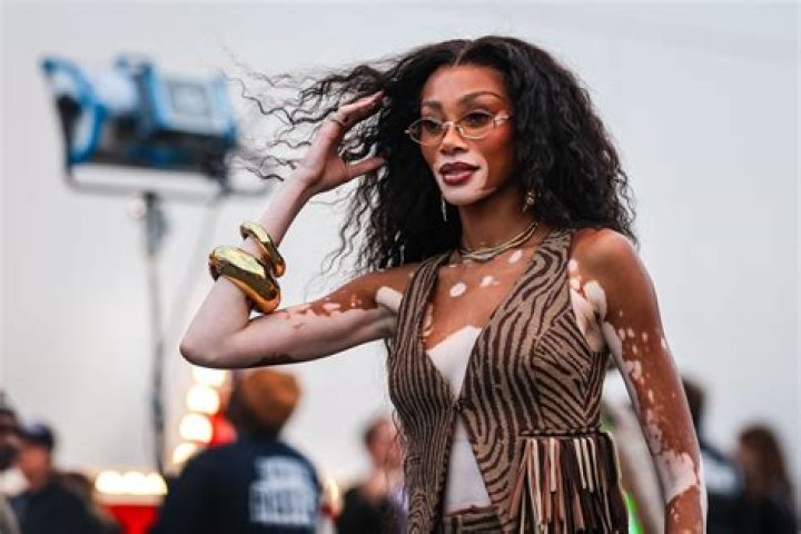 Winnie Harlow Net Worth | Celebrity Net Worth